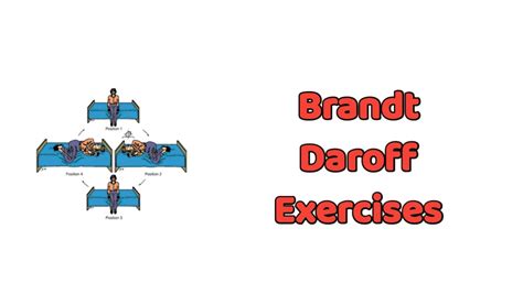 Brandt Daroff Exercises Pdf Free Download