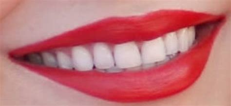 Miranda Cosgrove Teeth Pictures