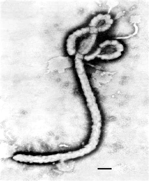 Composed of an rna or dna core, a protein coat, and, in more complex types, a surrounding envelope. Transmission electron microscope view of an Ebolavirus ...