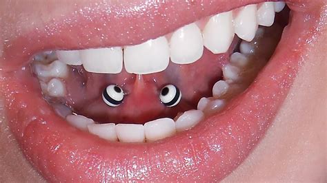Can a dentist tell if you had a brain job? What Your Dentist Wants You to Know About Your Oral ...