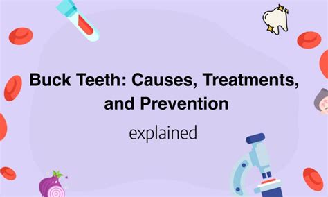 buck teeth causes treatments and prevention