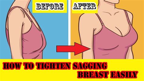 how to tighten sagging breast in just 1 month using this 5 ingredients youtube