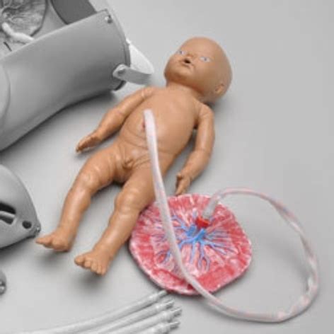 Watch for signs of infection (see. Fetal baby, Umbilical Cord, and Placenta for Vacuum Delivery