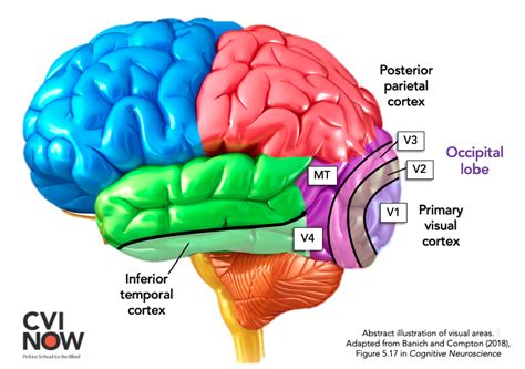 Higher Order Visual Pathways And The Cvi Brain Perkins School For The