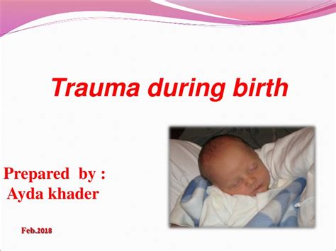 Ppt Trauma During Birth Powerpoint Presentation Free Download Id