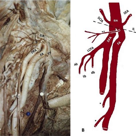 Image A And Schematic Drawing B Of The Deep Femoral Artery Dfa