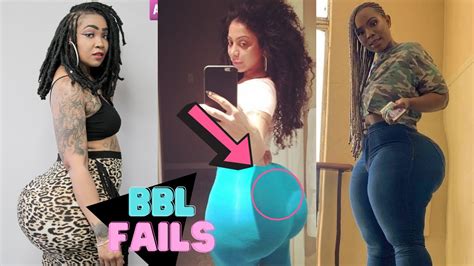 Bbl Fails Before And After Images Are Shocking Youtube