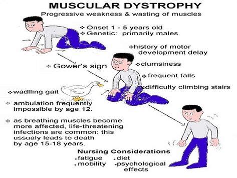 OT MUSCULAR DYSTROPHY Ideas Muscular Dystrophies Duchenne Muscular
