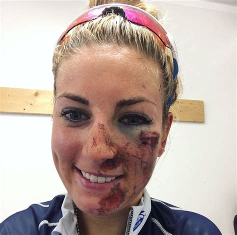 Find out more about pauline ferrand prevot, see all their olympics results and medals plus search for more of your favourite sport heroes in our athlete database. Mondiaux : Pauline Ferrand-Prévot défigurée après une ...