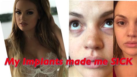 my breast implants made me sick the truth about breast implant illness youtube