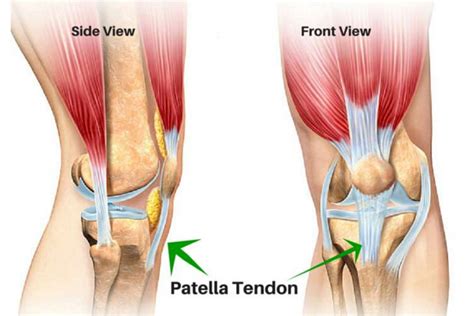 What Patellar Tendonitis Exercises Can I Perform New Health Advisor