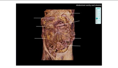 Abdominal Cavity And Viscera Diagram Quizlet