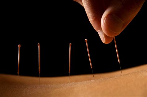 Acupuncture For Pain And The Secret Behind Its Effectiveness Blog