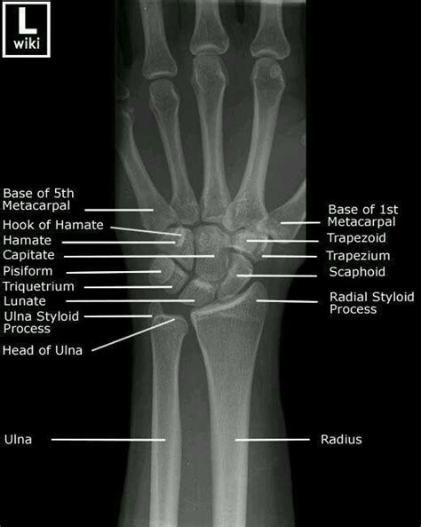 13 Best Images About X Rays On Pinterest X Rays