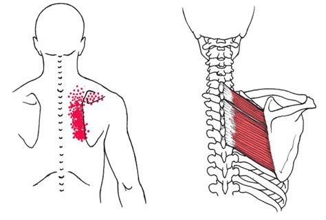 Rhomboid Muscle Pain How To Fix Pain In Shoulder Blade