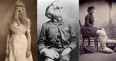 Tragic Photos From Freak Shows Of Decades Past