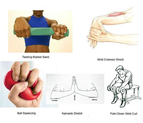 Printable Tennis Elbow Exercises