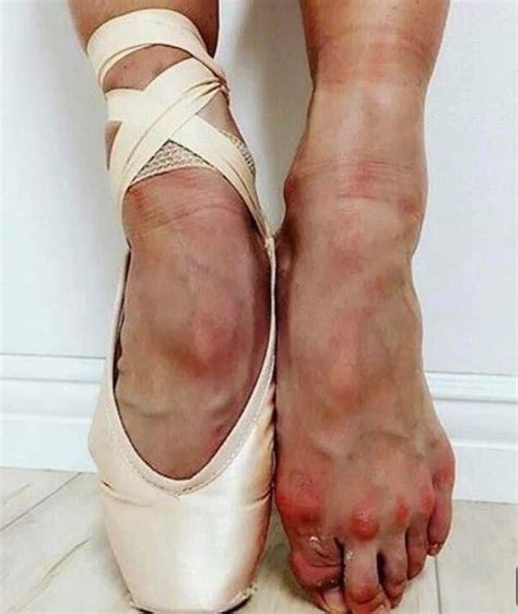 ‏ما وراء الجمال الذي نراه خلال رقص الباليه dancers feet ballet feet ballet dancers