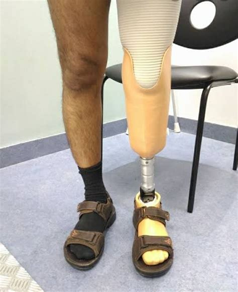 Functional Prosthetic Below Knee Prosthesis Artificial Limb Walking Id 23469006548