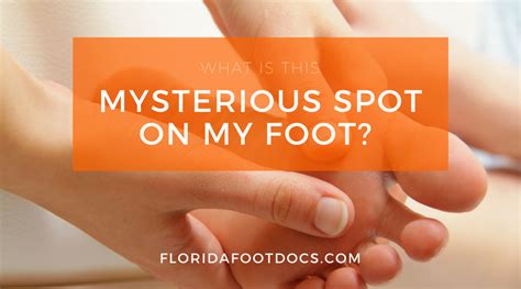 What Is That Spot On My Foot Foot And Ankle Associates Of Florida