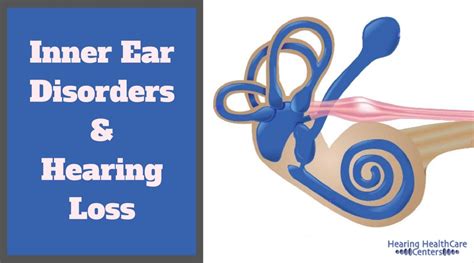 Inner Ear Disorders And Hearing Loss Hearing Healthcare Centers