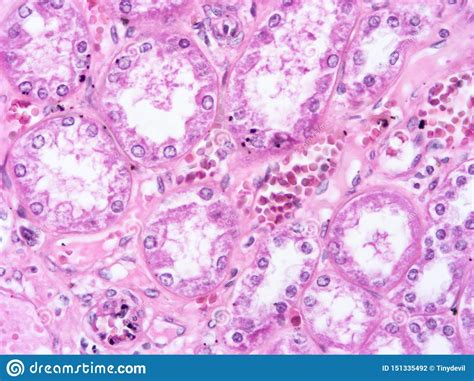 Histology Of Human Liver Tissue Stock Photo Image Of Gland