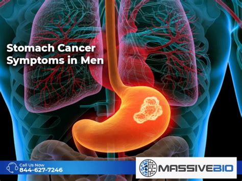 Stomach Cancer Symptoms In Men Why Does Stomach Cancer Occur