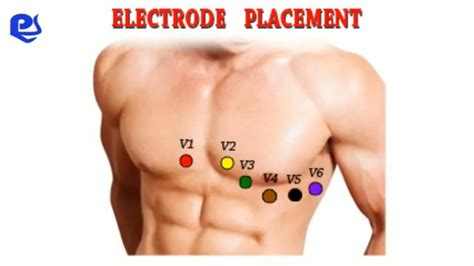 12 Lead ECG Electrode Placement