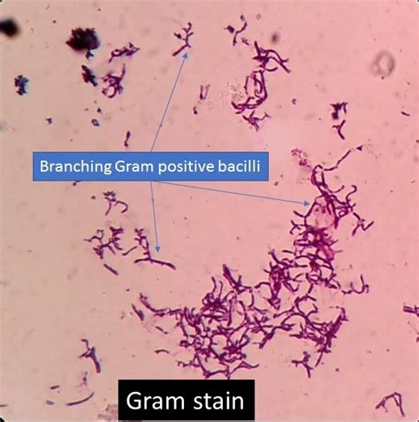 Branching Gram Positive Bacilli Introduction Principle