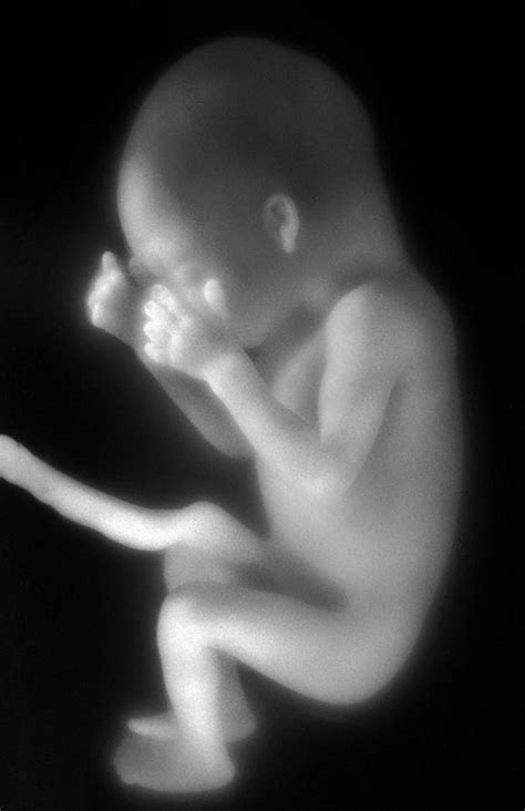 Human Foetus In The Womb Photograph By Science Photo Library