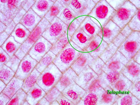 Here is a brief information about the list of organelles present in a plant cell and the roles they play in the overall functioning of a. Plant Cell In Interphase Under Microscope - Micropedia