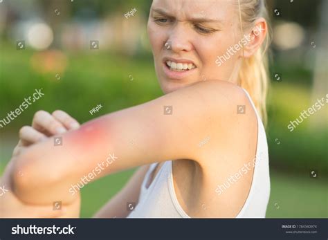 Itchy Insect Bite Irritated Young Female Stock Photo 1784340974