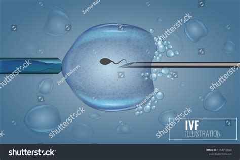 Vitro Fertilization Injection Artificial Insemination Scientific Stock