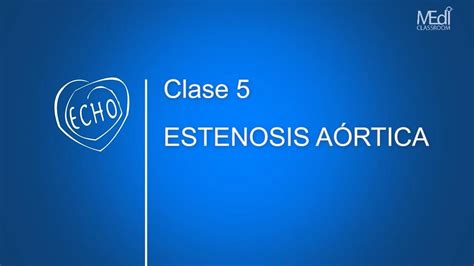 De wikipedia, la enciclopedia libre. CLASE 5 - Estenosis Aórtica - YouTube