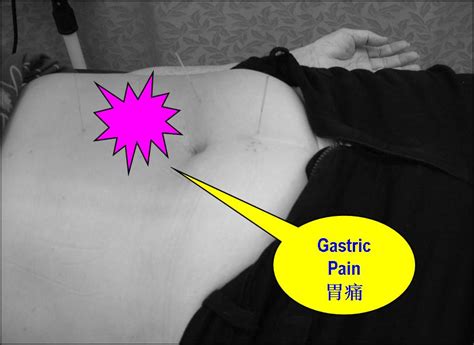 This prospective study was performed to substantiate the impression that patients with ibs experience more pain during endoscopic. TCM News: Go to TCM for Gastric Pain and Irritable Bowel ...
