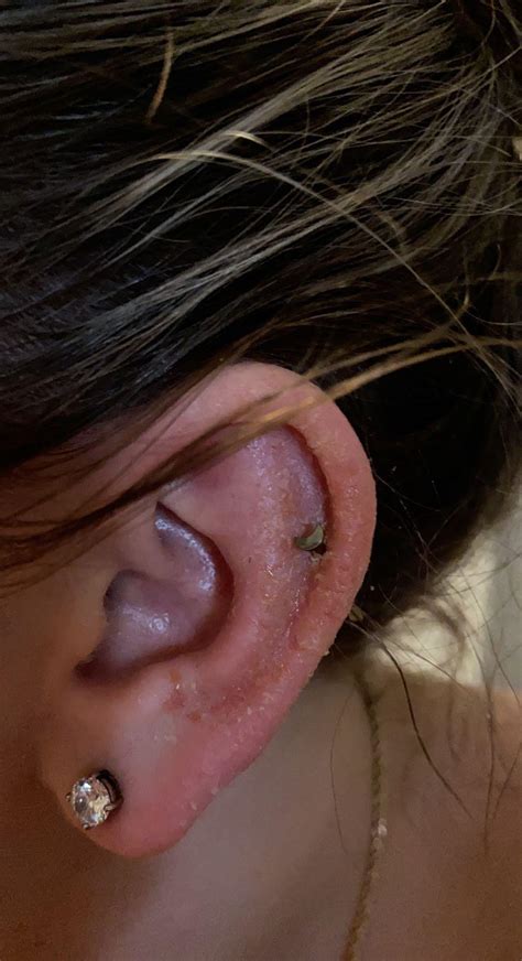 a guide on how to treat allergic reaction to earrings a fashion blog vlr eng br
