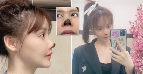 Chinese Actress Warns Fans Against Plastic Surgery After Tip Of Nose