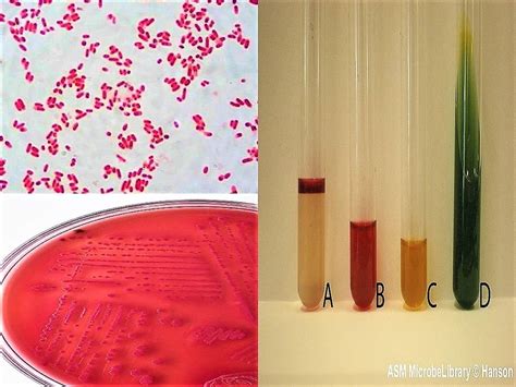 Biochemical Tests For Escherichia Coli E Coli Bacteriology Notes