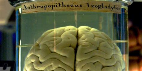 100 Human Brains Have Gone Missing From The University Of Texas