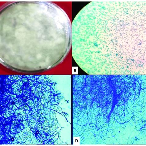 Light Microscopic Images Of A P Lilacinus Fungus Culture On Pda