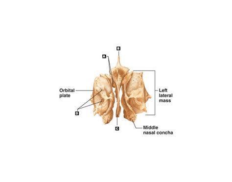 Ethmoid Bone Quiz