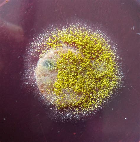 Aspergillus flavus has a worldwide distribution and normally occurs as a saprophyte in soil and on many kinds of decaying organic matter, however, it is also a recognised pathogen of humans and. Aspergillus flavus | Mold XPerts