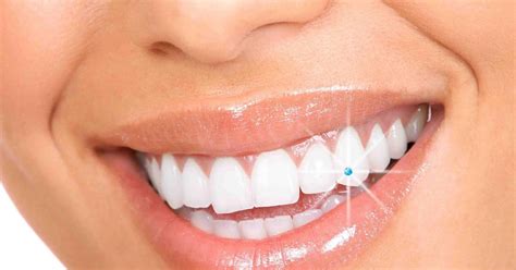 What Is Tooth Jewelry Top Notch Dental
