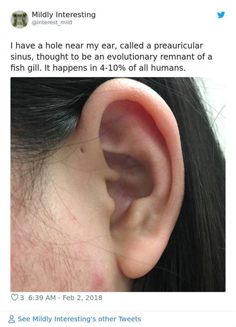 But What If That Tiny Hole Above Your Ear Serves A Purpose 8 Pics 1