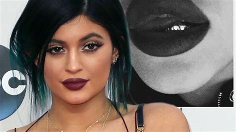 Kylie Jenner Shows Off Her Grill And Super Plumped Lips In Close Up