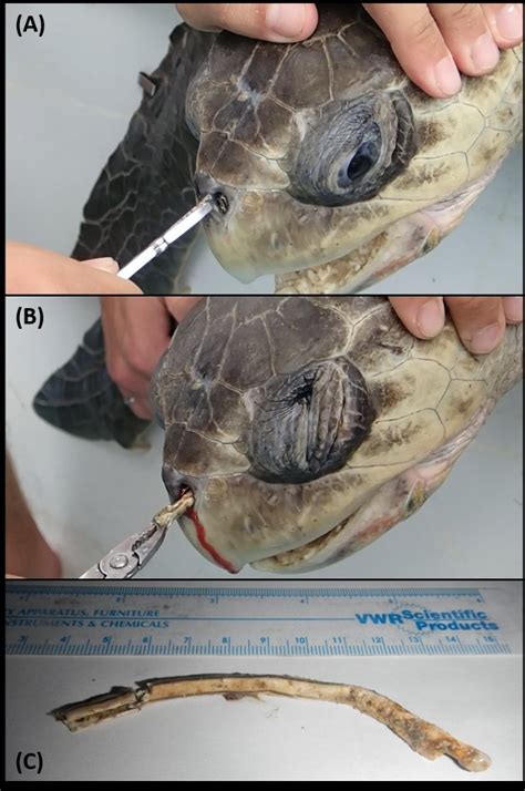 A Plastic Straw In The Left Nostril Of An Olive Ridley Sea Turtle
