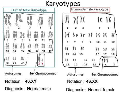 Human Chromosome Chart