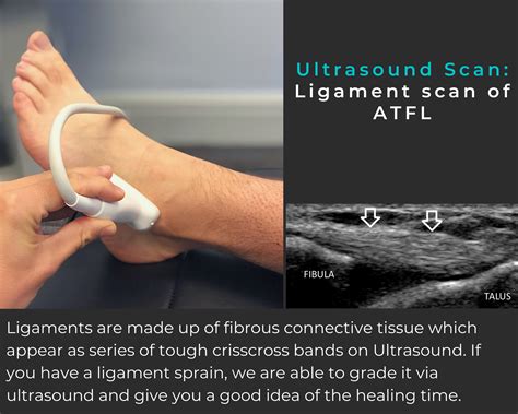 Ultrasound Scan — Lb Physio