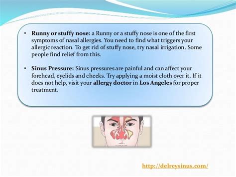 5 Nasal Allergy Symptoms You Should Not Ignore
