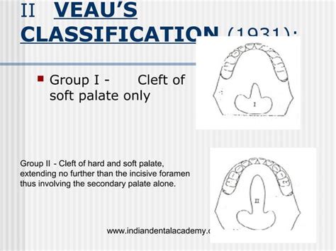 Cleft Lip And Palate Importance In Orthodontics Certified Fixed